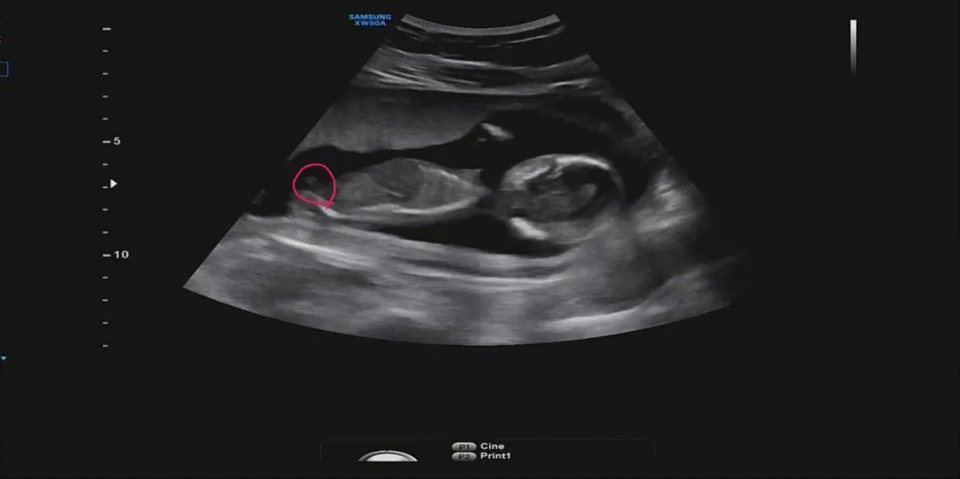 16주 성별 꼭 한번씩 봐주세여..!! 해삐뉴이어🤍 