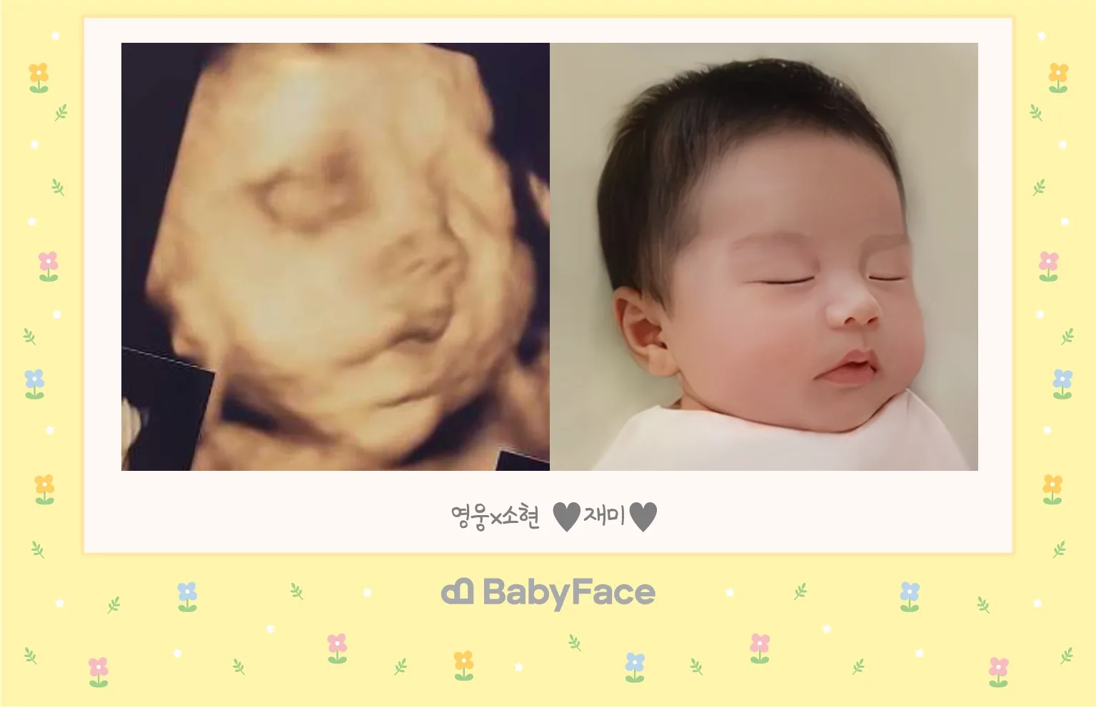 베이비페이스 후기