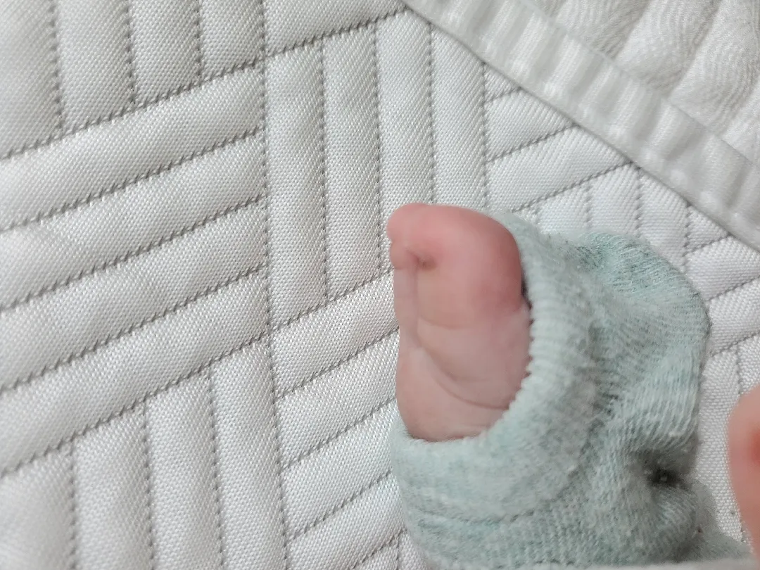 아기 발톱이여..