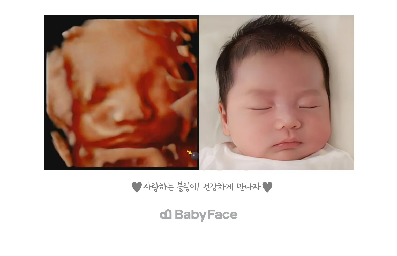 베이비페이스 넘 귀여워요>_<