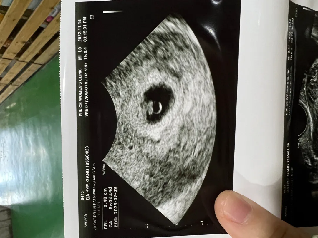 6주2일차 심장소리라뇨🥹