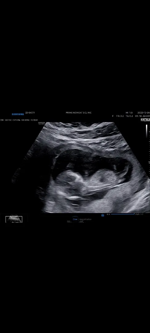성별알수있을까용?? 👶👶