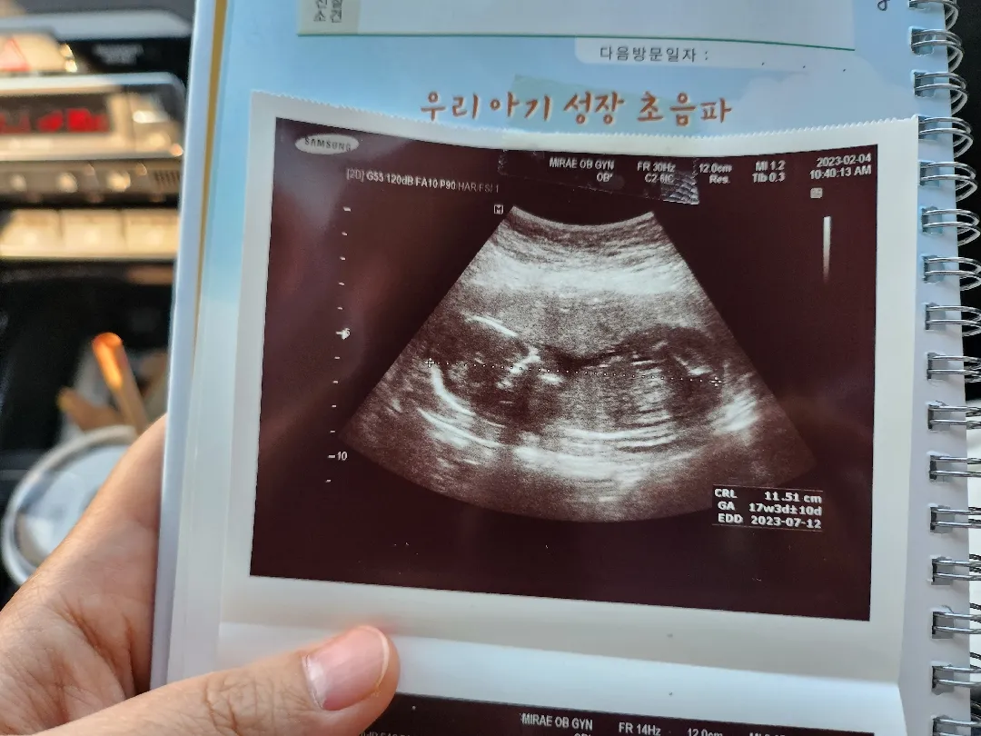 성별 거의(?) 확정 받았어요🥰