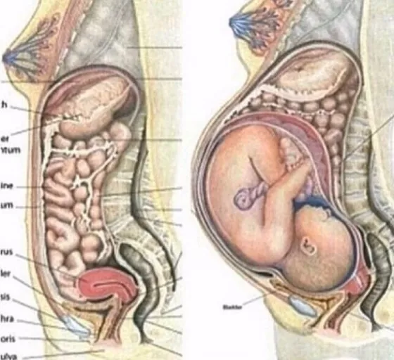 폭풍 배탈 윗배 아픔