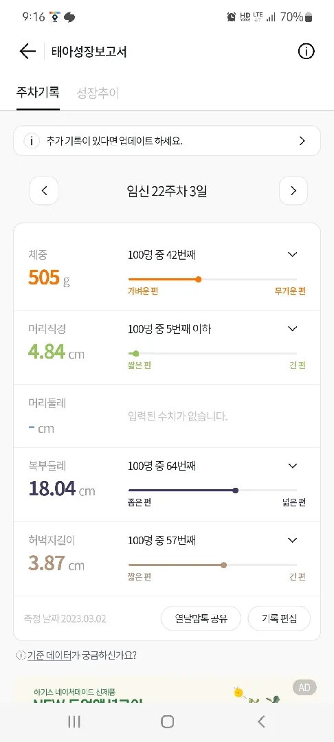 머리직경 짧은데, 너무 소두아닌가요ㅠ