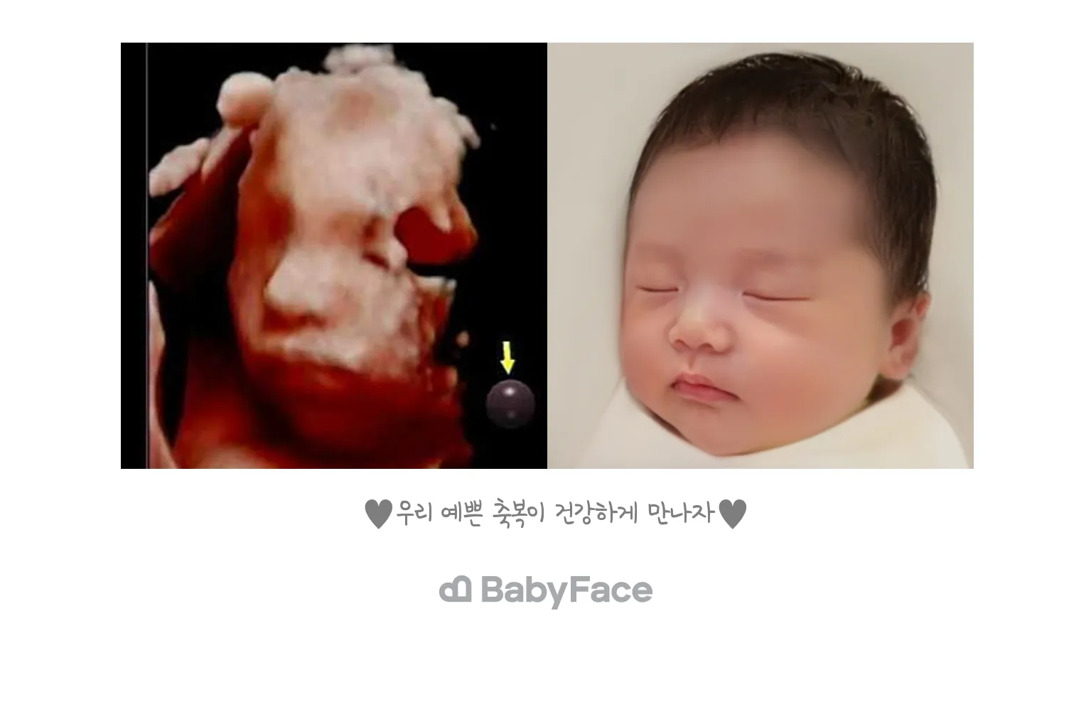 베이비페이스 결국 했어요!