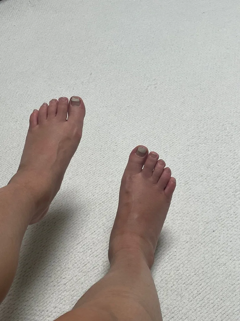 26주 발붓기(사진혐)