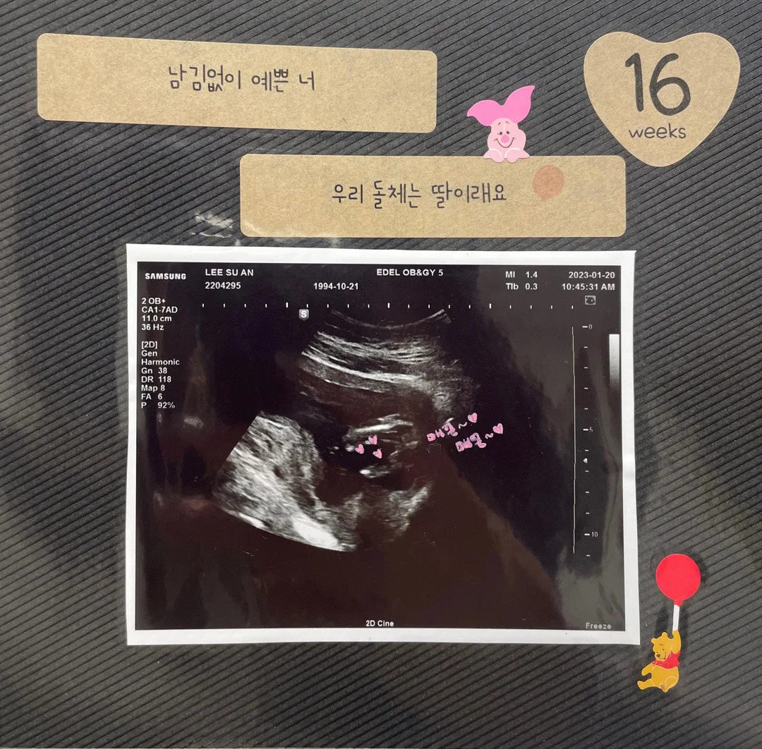 15주6일 성별확인