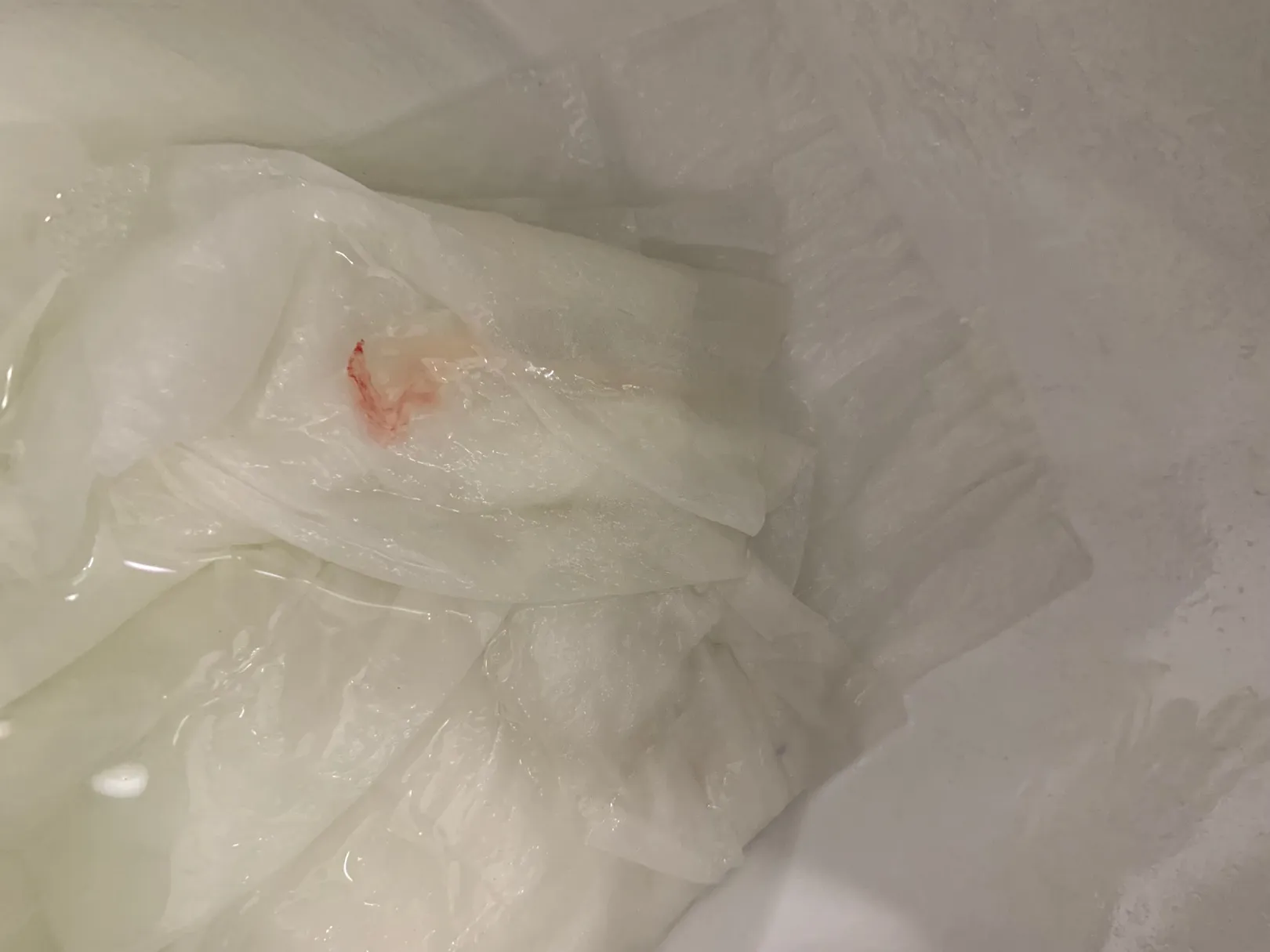 어제 5주 병원 갔었거든요~ 아직 아기집은 못본 상태
