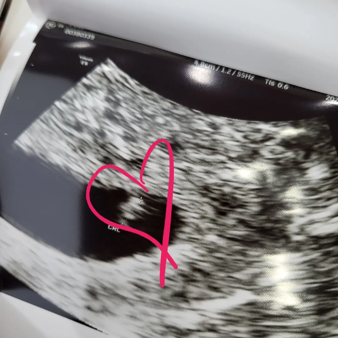 예쁜아가의 심소를 들은 소감이....💓🥹👶🏻