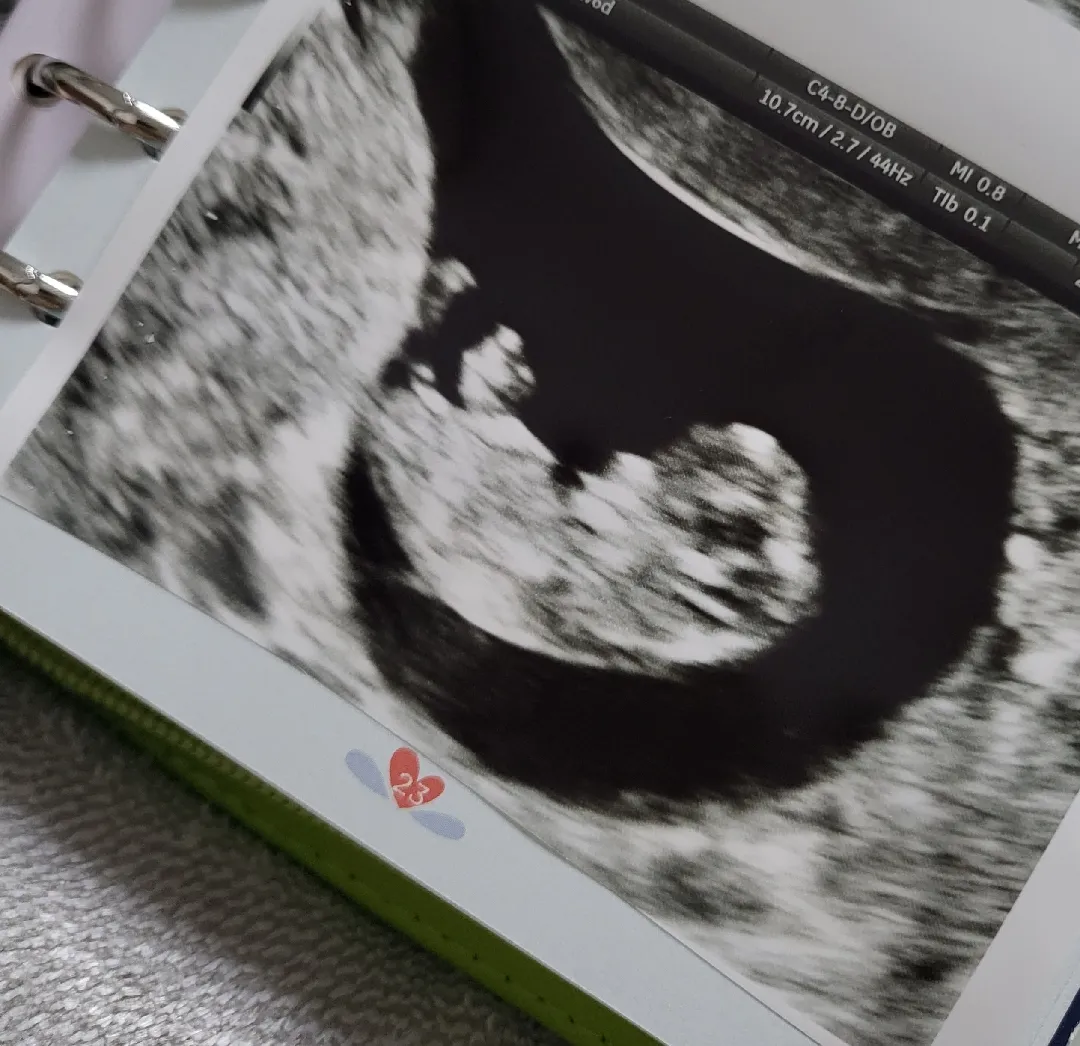 귀여운👶🏻기쁨이 9주+6일차!D-211