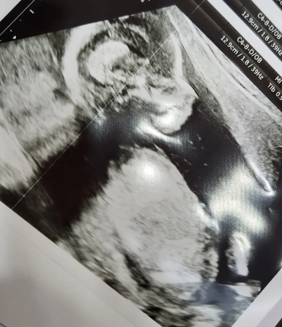 16주 4일차👶🏻