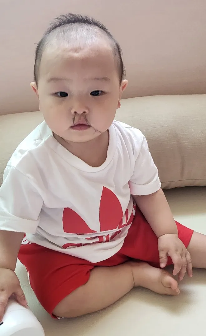 10개월차... 뒤돌아서며는 사고쳐요