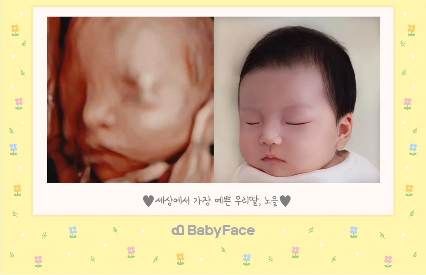 저희도 베이비페이스했어요 ㅎㅎㅎ