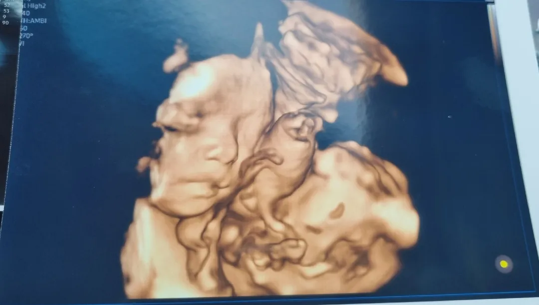 28w5d 입초하고왔어요 ^^