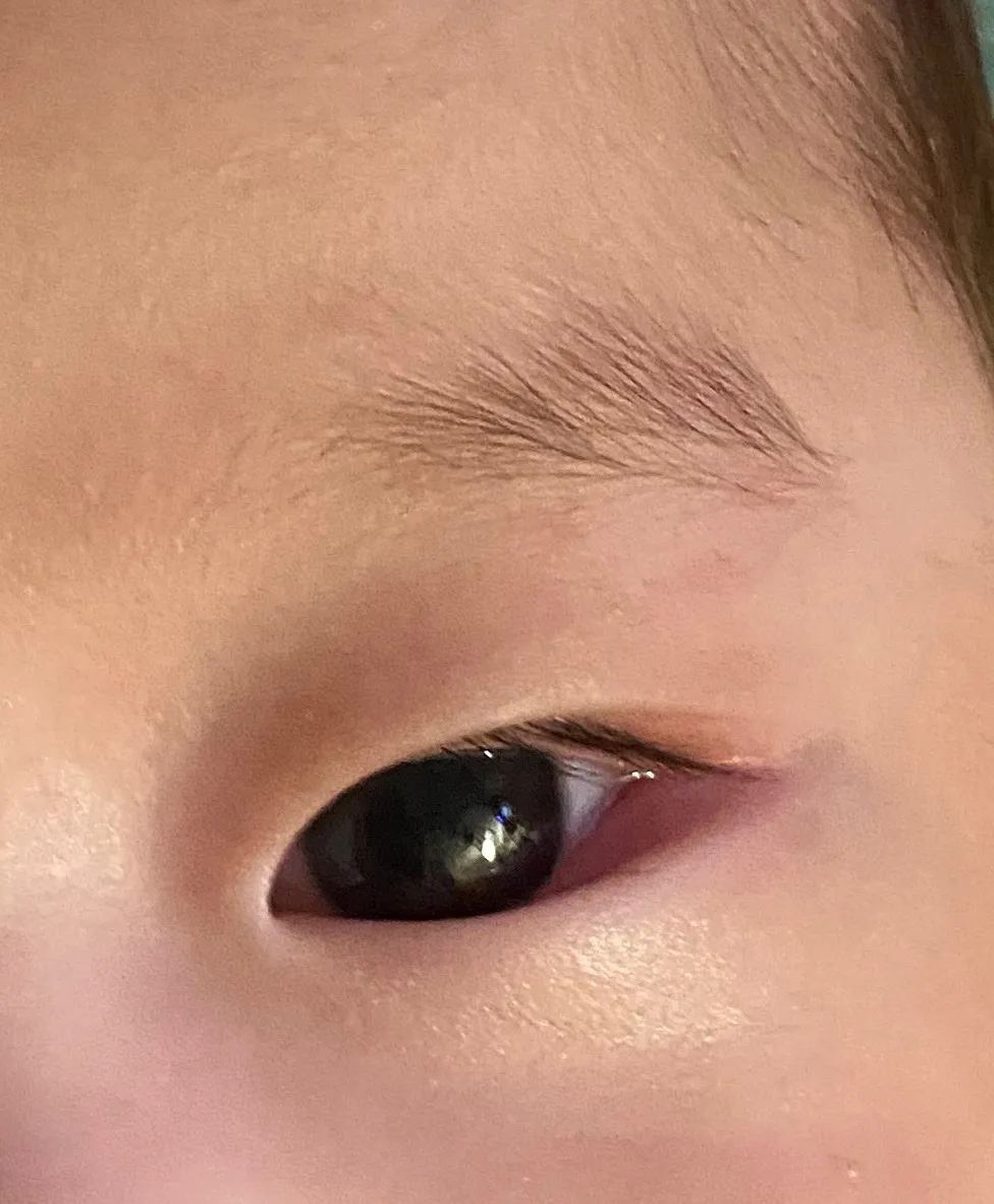 아기 눈물