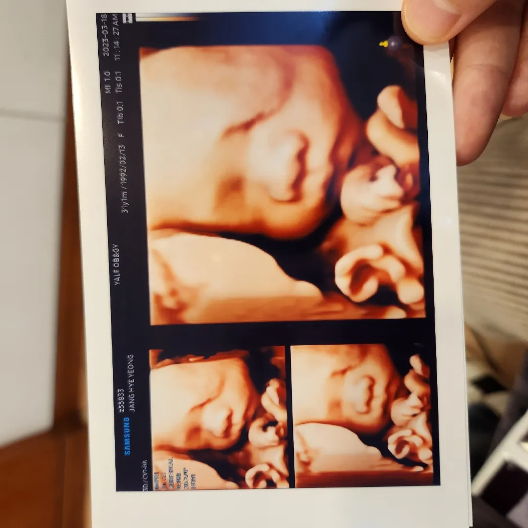 27주 입체초음파,임당검사 하고왔어요😆