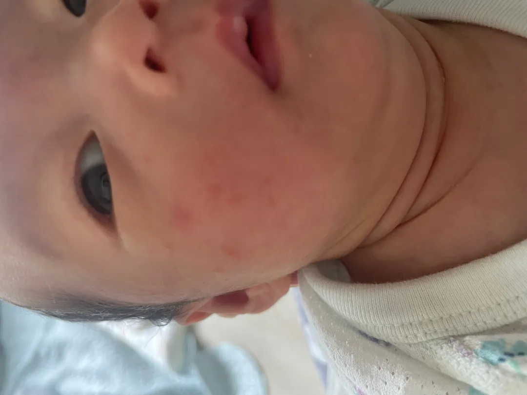 아기 얼굴 좀 봐주세요ㅠㅠ