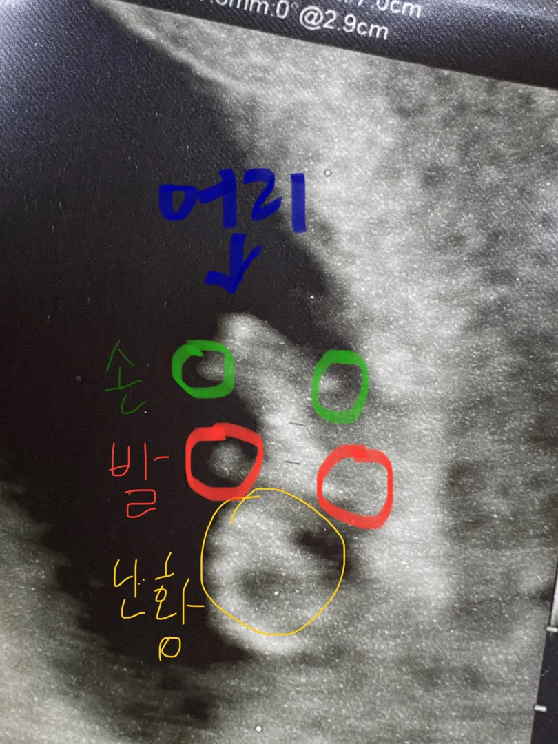 초음파 잘 보시는 분!!