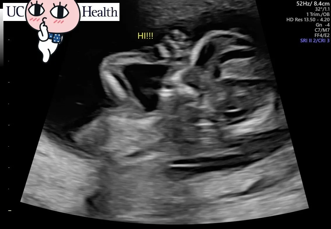 덤블링 좋아하는 포키입니다🤰