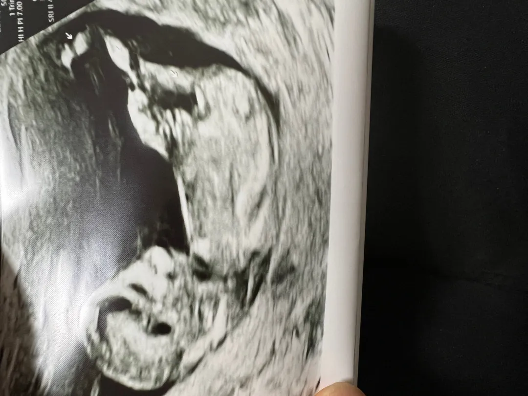 오늘 초음파 찍었는데 성별이 궁금해요 ㅎㅎ