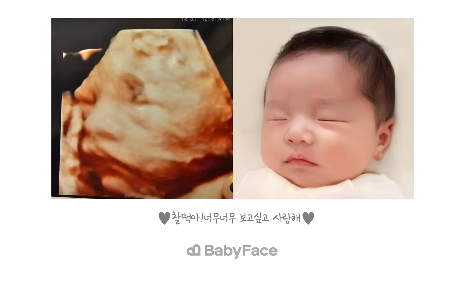 베이비페이스 했어요ㅎㅎ