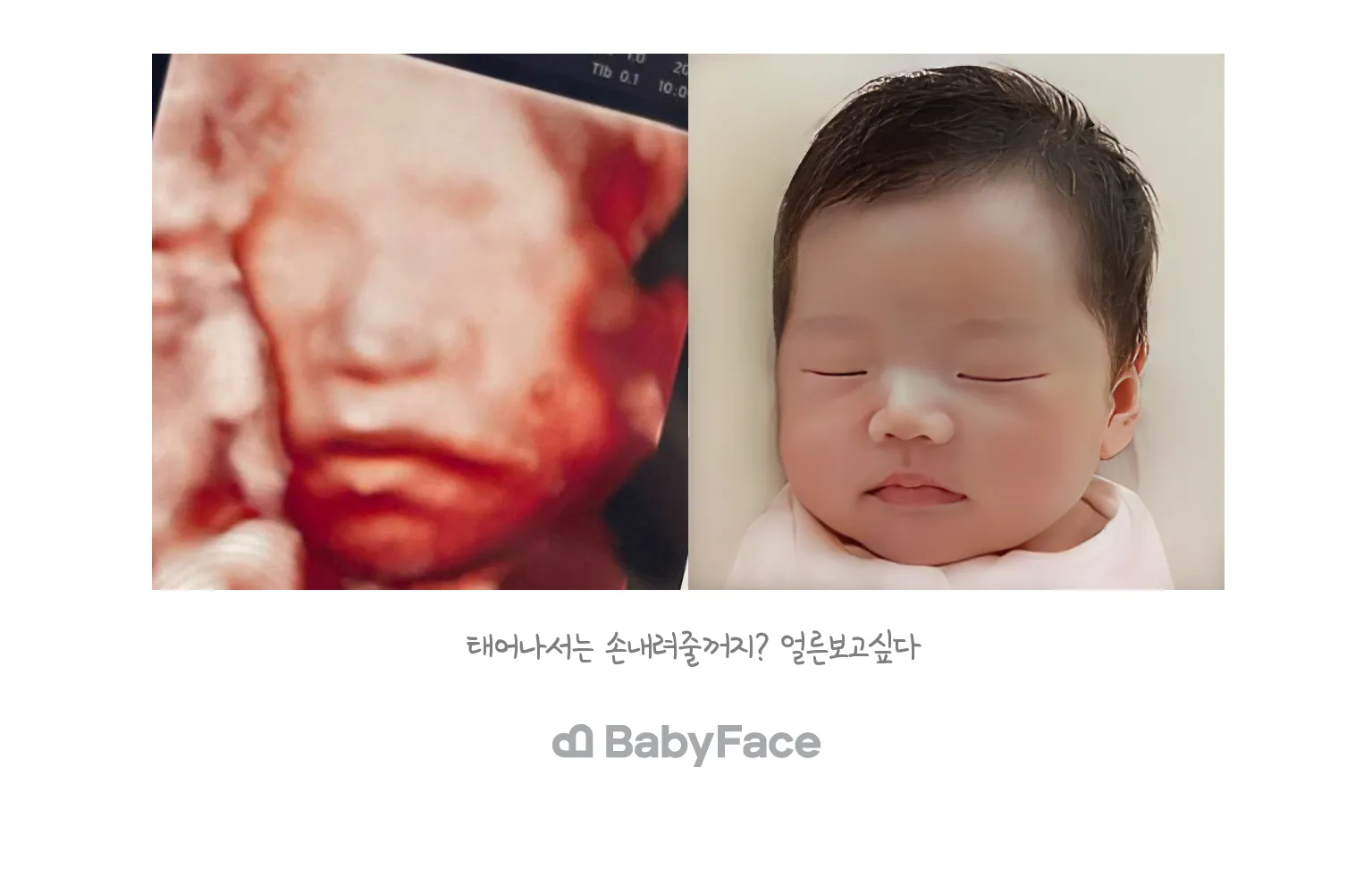 저두 베이비페이스 햇어요!