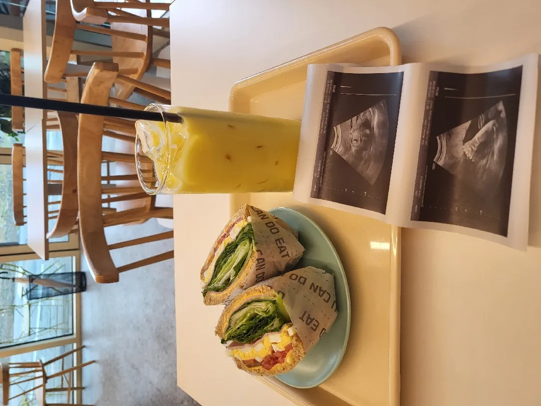 애기 보고싶어서 보고 온 날 ❤️