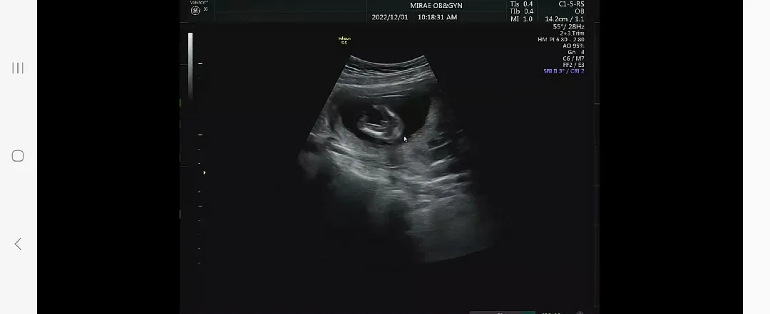 다리사이 보이는건 꾜츄맞죠?