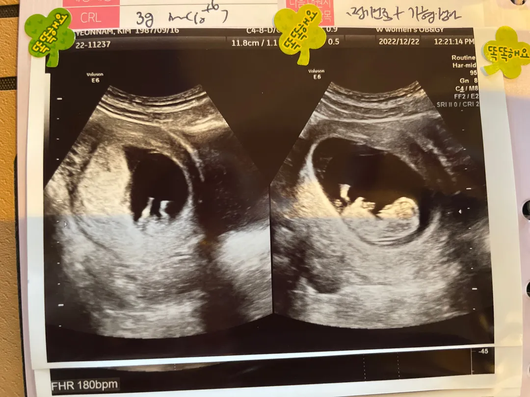 10주 1일차! 아기곰 사진👶