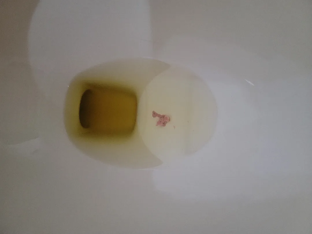 (극혐주의)어디에 여쭤봐야할지 몰라서 이곳에 여쭤봅니다ㅠ(연분홍냉 덩어리 사진첨부)