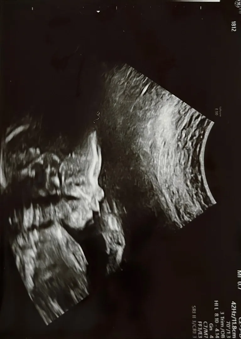 정밀촘파❤️👶🏻