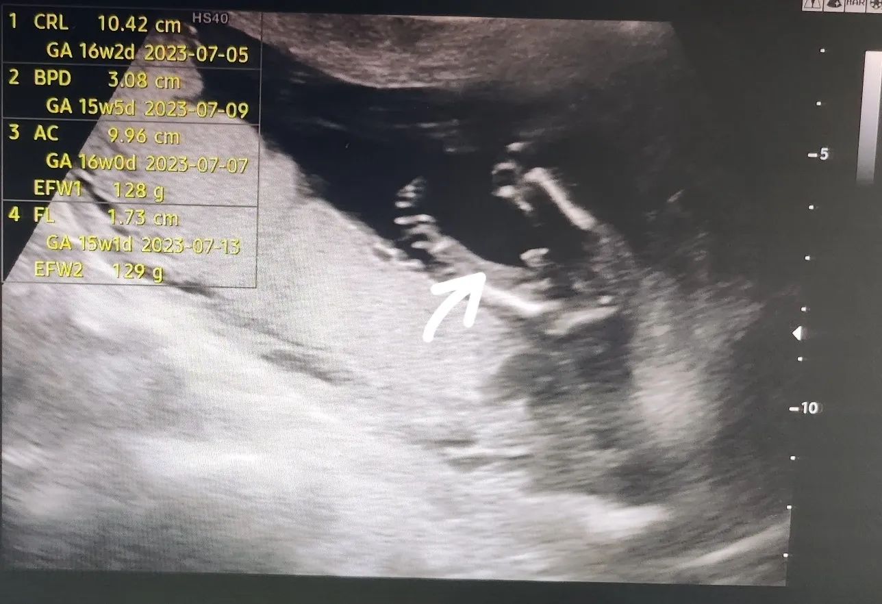아기 성별 언제쯤 공개하실 계획이신가요~?