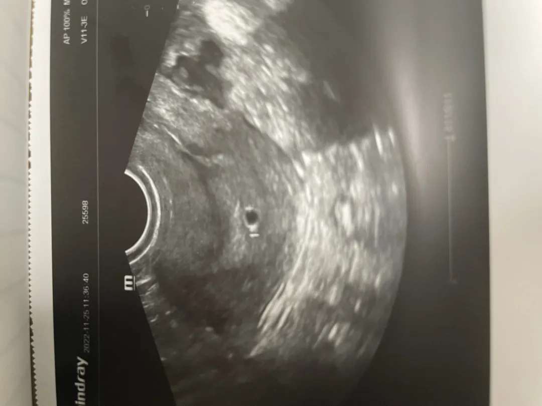임신한거 맞나..? 싶을정도로 아무렇지도 않네요ㅠㅠ