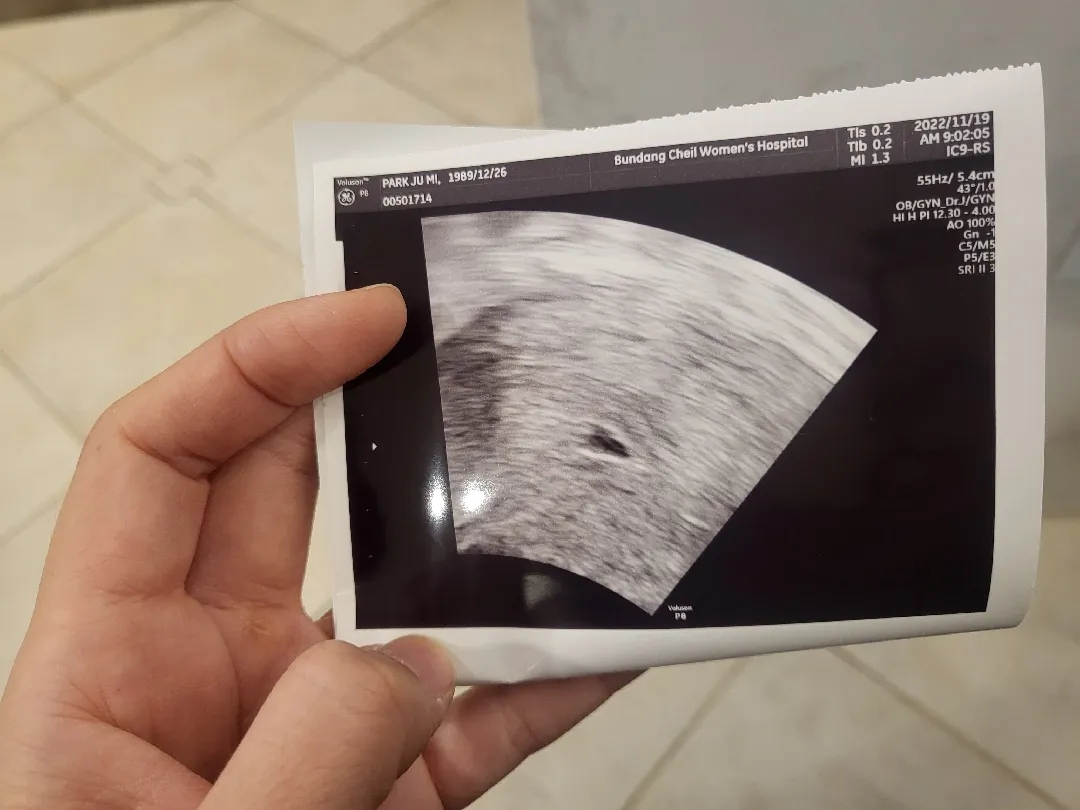 두차례 유산 후 세번째 임신입니다...!