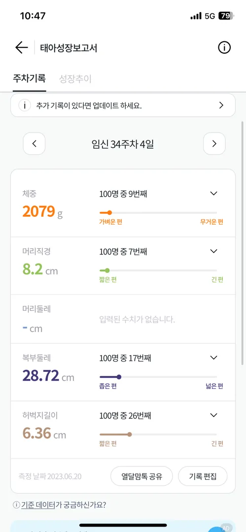 34주 태아 무게
