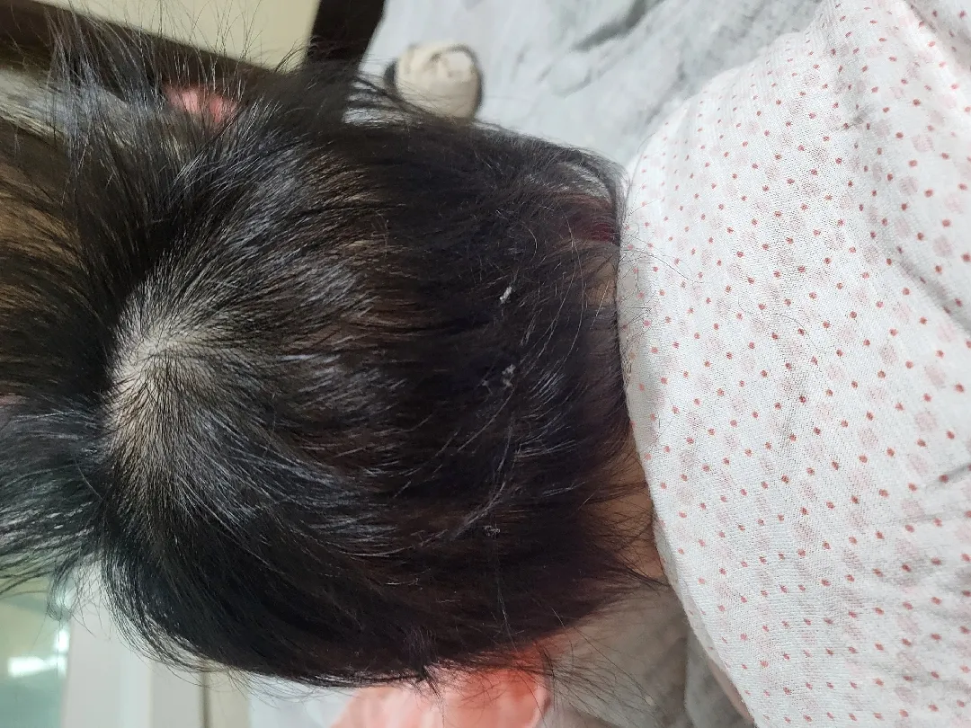 머리카락 원래 이렇게 엉키나요 