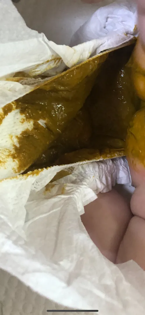 분유문제 