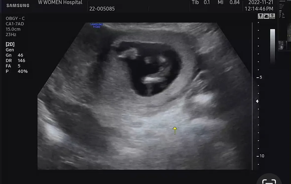 12주2일 🌶️ 확정 
