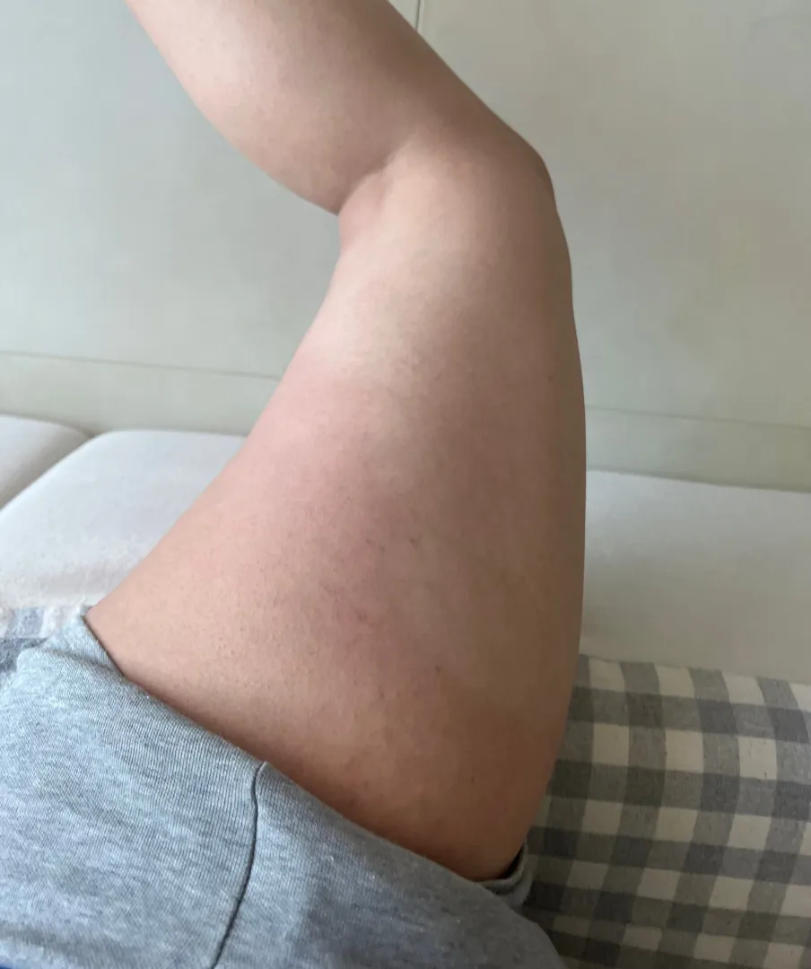 다리색 변화