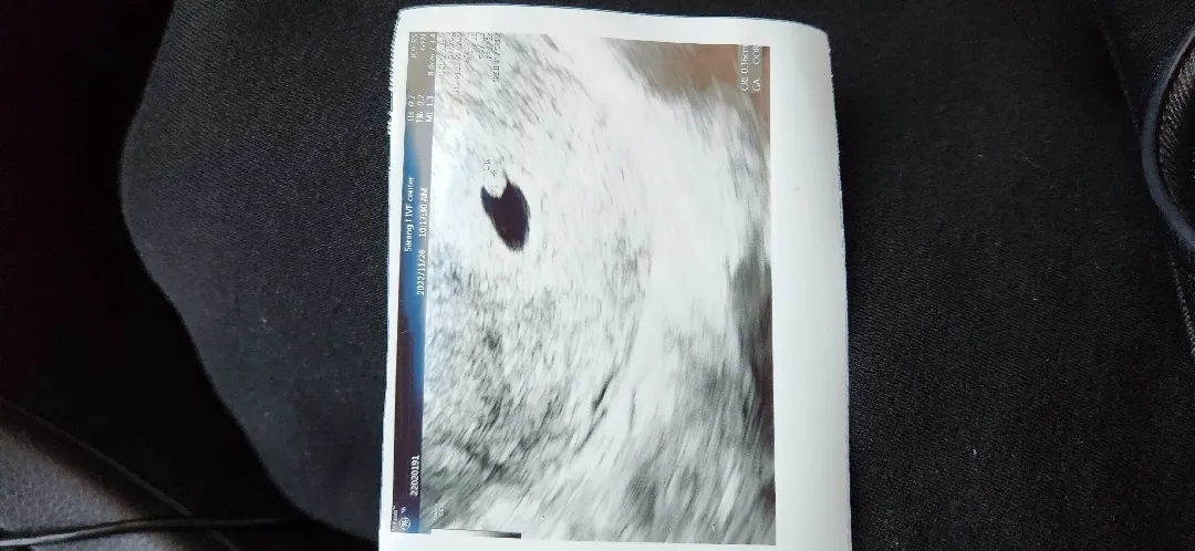 오늘 병원갔는데 난황보이면 괜찮은건가요?