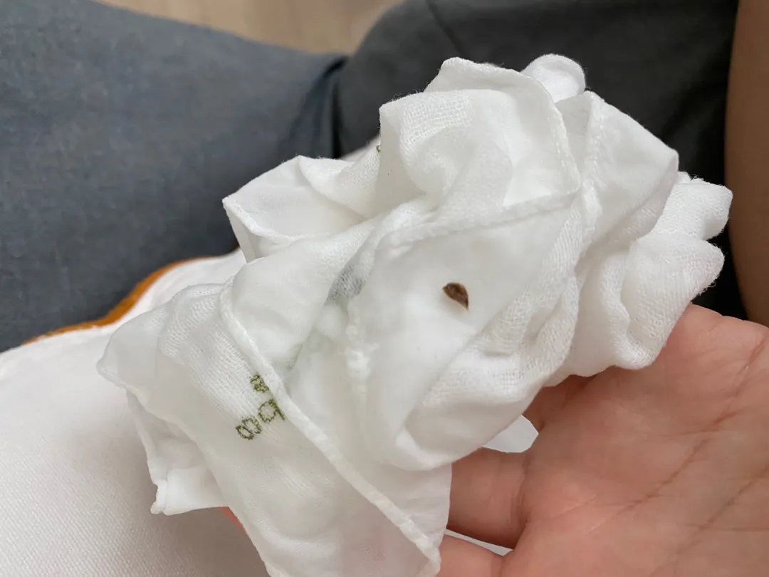 아기 귀에서 까만딱지..? 