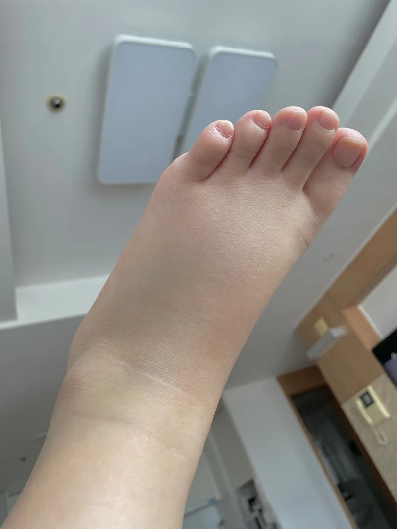 발...