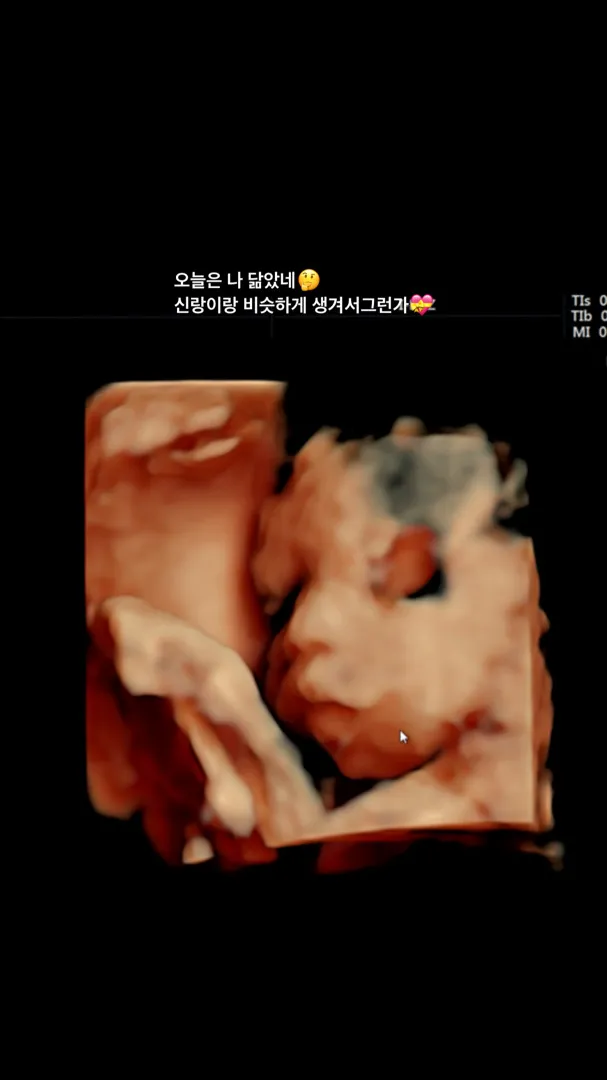 28주 검진 다녀왔어요 ! 앞으로 2주마다 오래용!! 