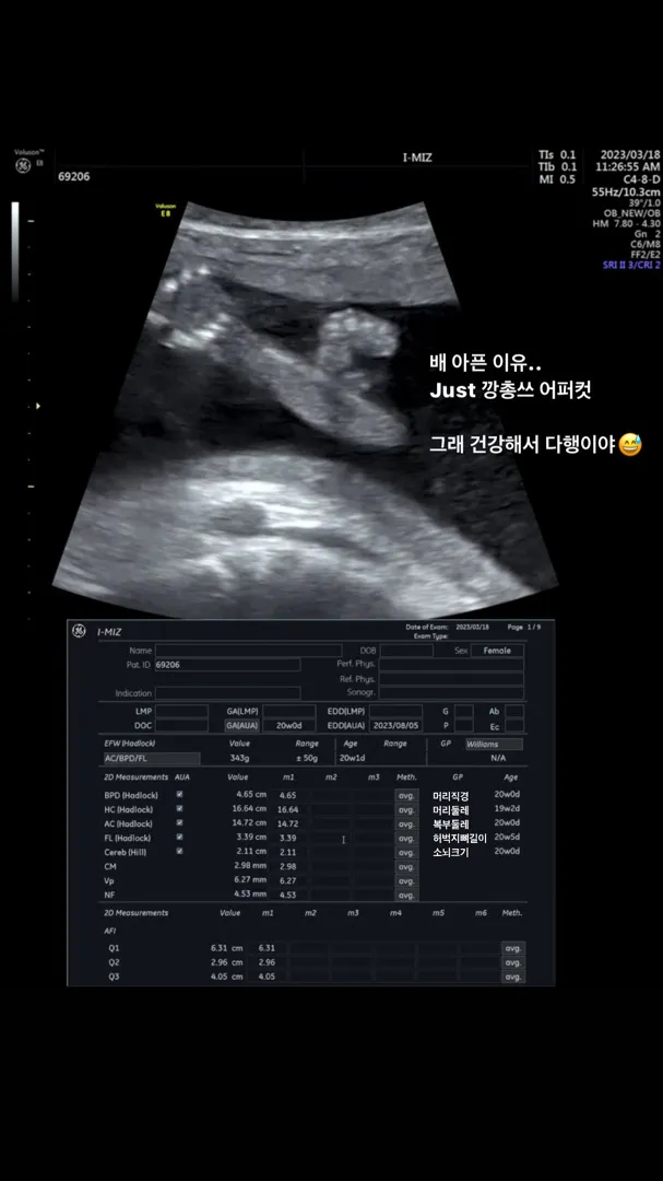 저 조산기있는가싶어서 병원갔는데 배뭉침너무심하고 통증 심해서요 반전주의