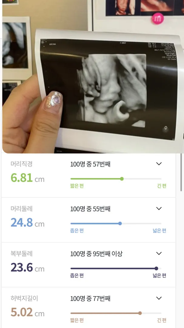 26주 4일 저 금요일에 만삭촬영이라 입체초음파찍으러 다녀왔어요