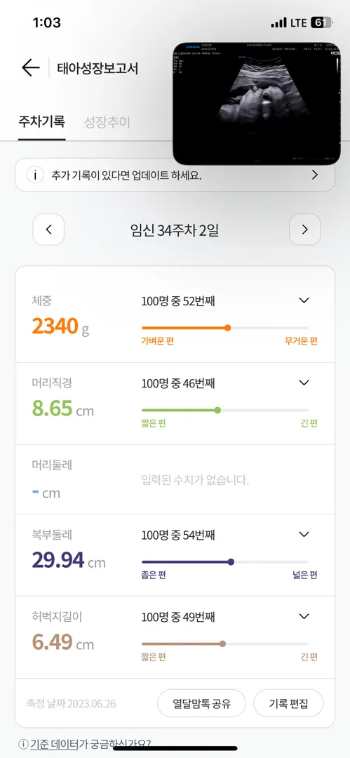 37주 6일로 수술날짜 잡았어요..! 