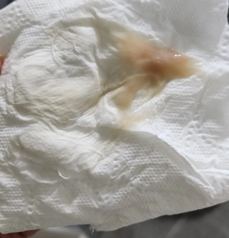 혐오짤ㅠㅠㅠ38주6일차입니당