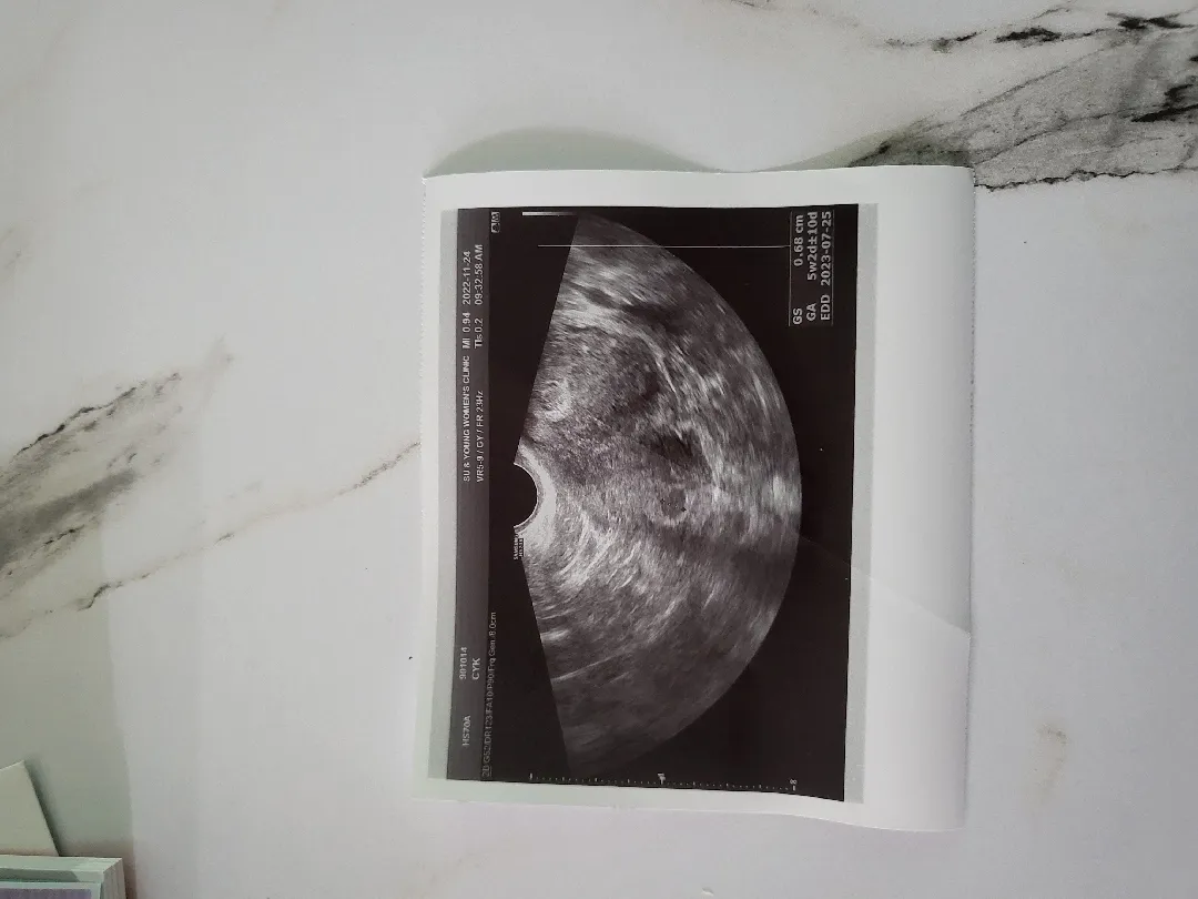 궁금해서 물어봐요..
