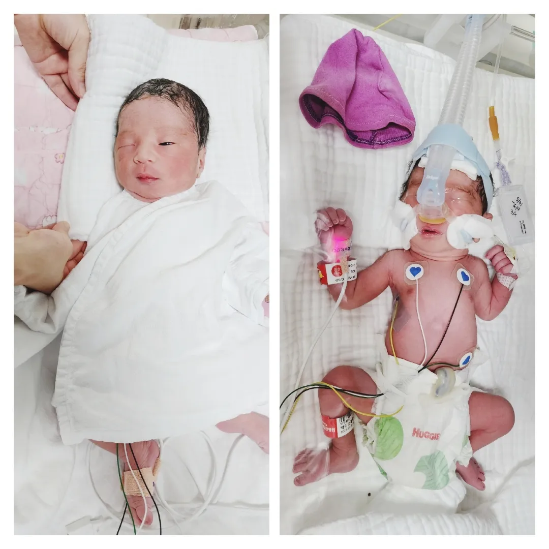 7월베동 3번째신고식)5월31일 형제둥이 출산했습니다ㅎㅎ